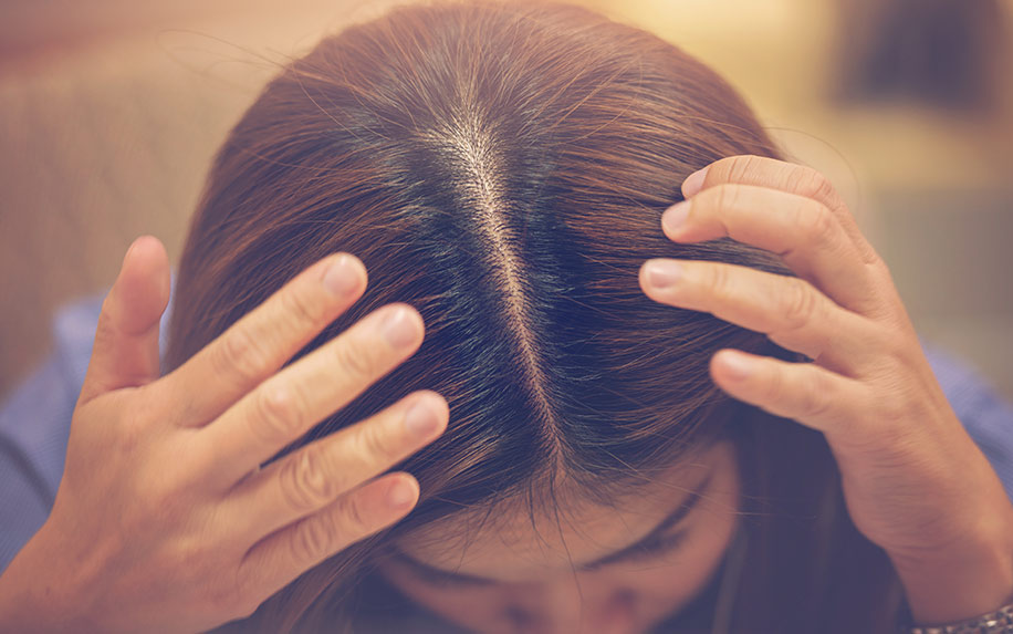 Cannabis Terpenes May Be the Key to Stopping Scalp Fungus